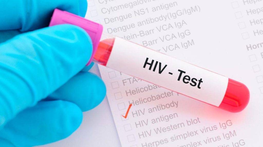 Tổng hợp các phương pháp xét nghiệm HIV phổ biến nhất hiện nay 1 Thời gian xét nghiệm HIV