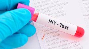 Thời gian xét nghiệm HIV
