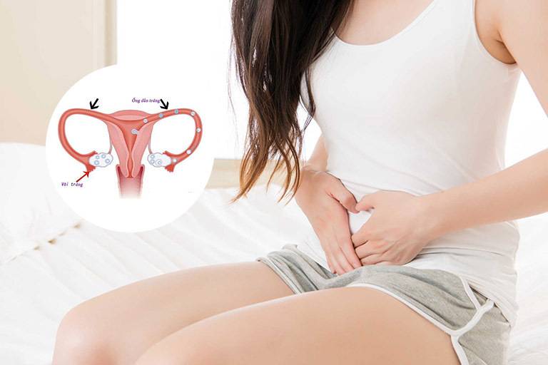 Các bệnh phụ khoa thường gặp hiện nay và cách phòng tránh 3 Dấu hiệu cảnh báo viêm âm đạo