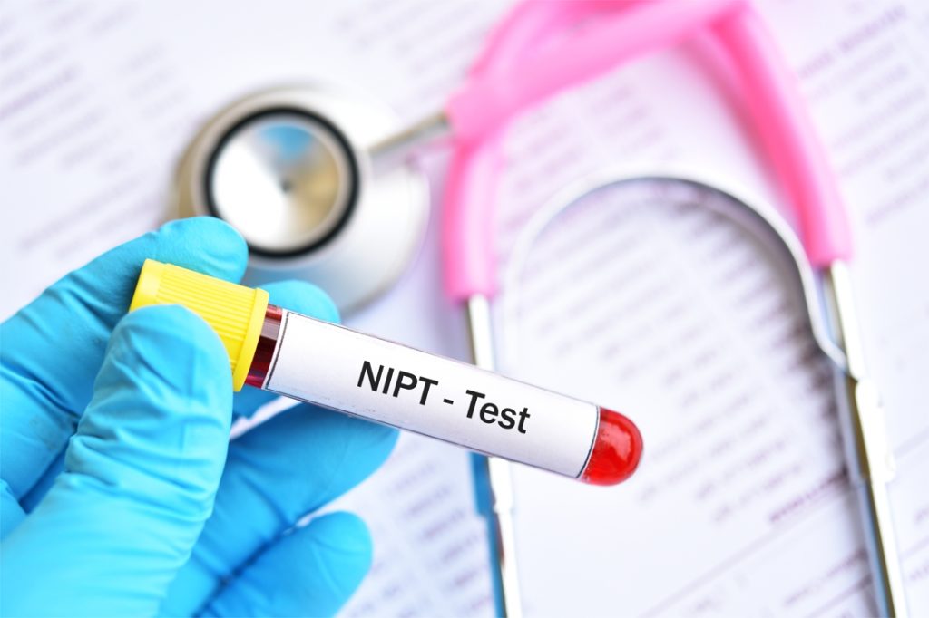 Tổng hợp thông tin xét nghiệm sàng lọc dị tật thai nhi mẹ bầu cần biết 3 Xét nghiệm sàng lọc dị tật thai nhi không xâm lấn NIPT