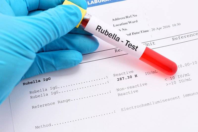 Tổng hợp những xét nghiệm cần thiết mẹ cần làm khi mang thai 4 Xét nghiệm rubella
